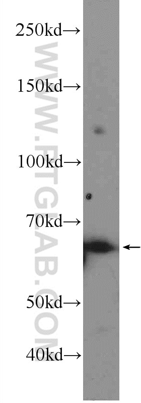 Western Blot (WB) analysis of HeLa cells using RNF8 Polyclonal antibody (14112-1-AP)