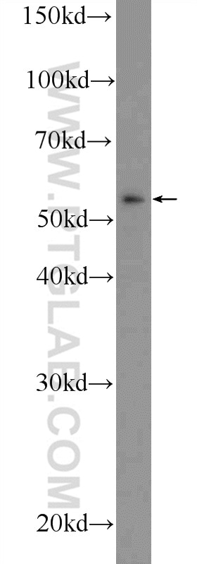 Western Blot (WB) analysis of SMMC-7721 cells using RNFT2 Polyclonal antibody (25685-1-AP)