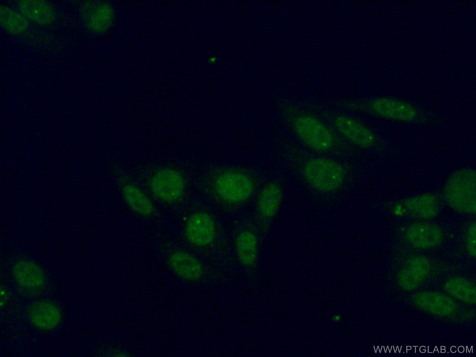 Immunofluorescence (IF) / fluorescent staining of HepG2 cells using RNGTT Polyclonal antibody (12430-1-AP)
