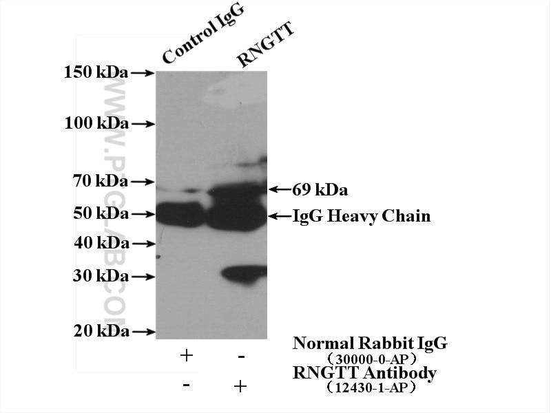 Immunoprecipitation (IP) experiment of mouse kidney tissue using RNGTT Polyclonal antibody (12430-1-AP)