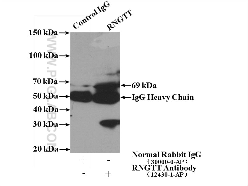 IP experiment of mouse kidney using 12430-1-AP