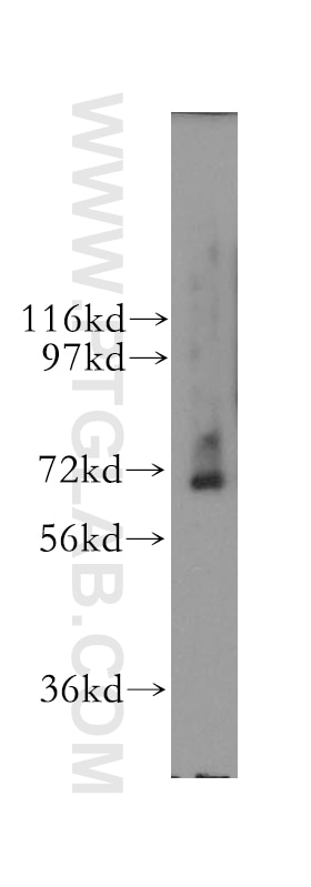 Western Blot (WB) analysis of human kidney tissue using RNGTT Polyclonal antibody (12430-1-AP)