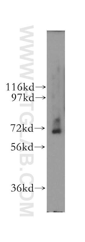 Western Blot (WB) analysis of human kidney tissue using RNGTT Polyclonal antibody (12430-1-AP)