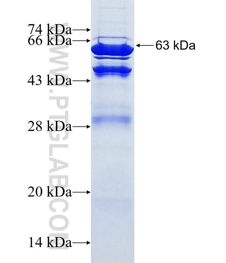 RNGTT fusion protein Ag3105 SDS-PAGE