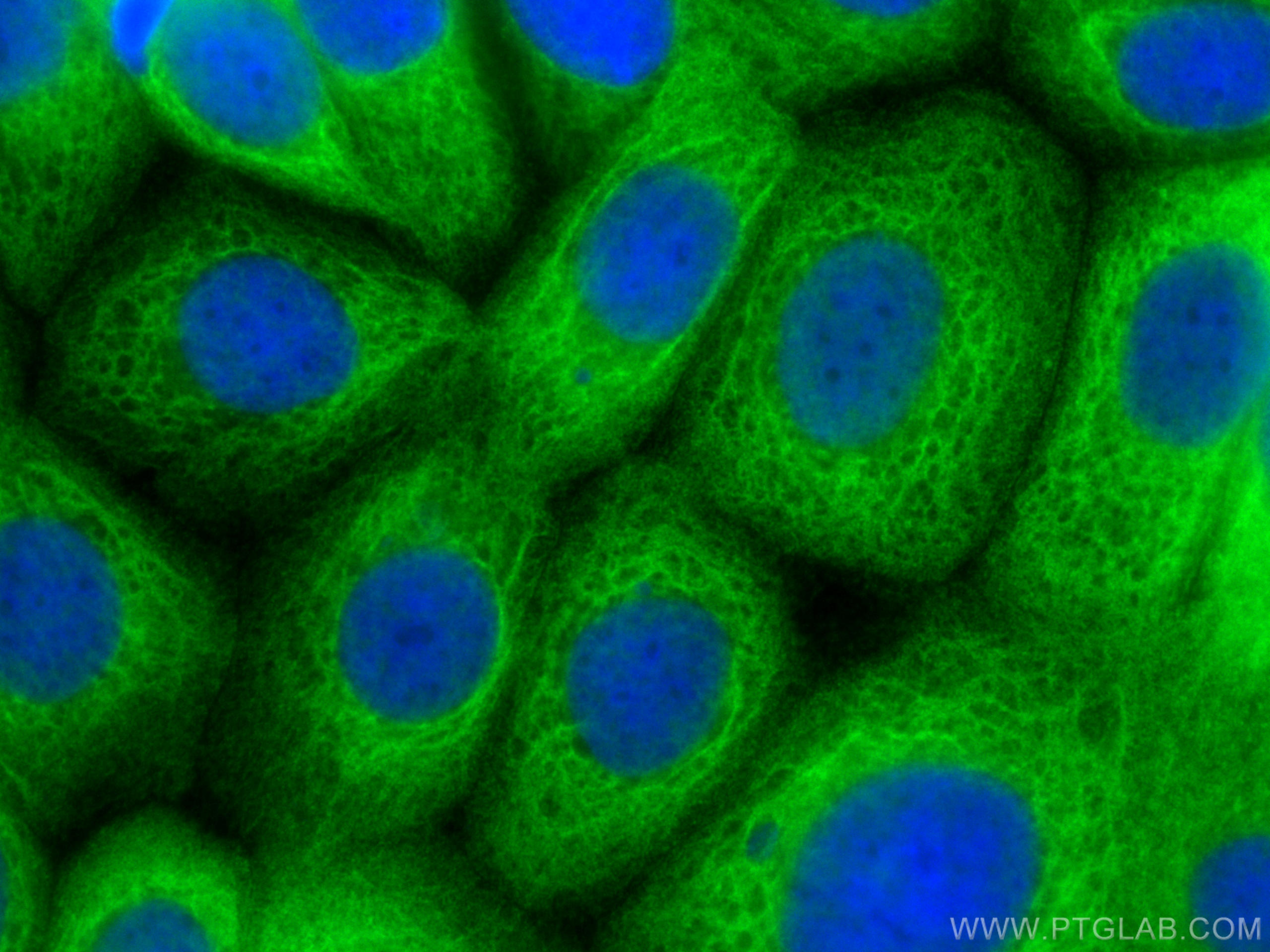 Immunofluorescence (IF) / fluorescent staining of MCF-7 cells using RNH1 Polyclonal antibody (10345-1-AP)