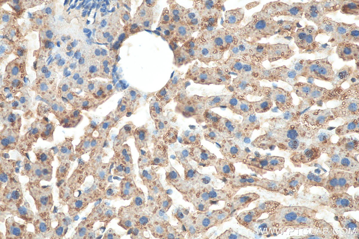 Immunohistochemistry (IHC) staining of mouse liver tissue using RNH1 Polyclonal antibody (10345-1-AP)