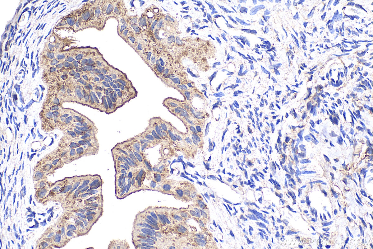 Immunohistochemistry (IHC) staining of mouse ovary tissue using RNH1 Polyclonal antibody (10345-1-AP)