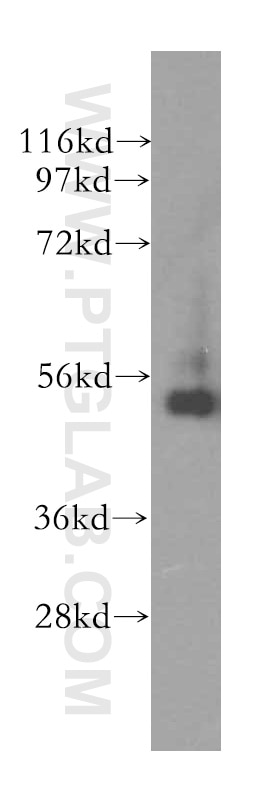 Western Blot (WB) analysis of human brain tissue using RNH1 Polyclonal antibody (10345-1-AP)