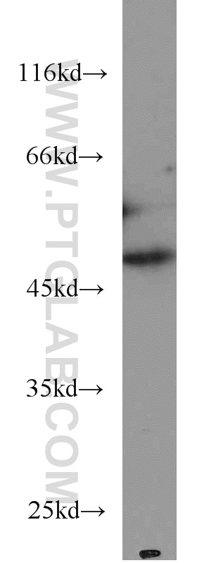 Western Blot (WB) analysis of HeLa cells using RNH1 Monoclonal antibody (66028-1-Ig)