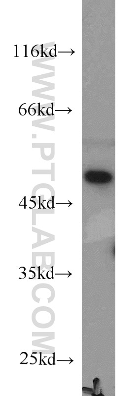 Western Blot (WB) analysis of Jurkat cells using RNH1 Monoclonal antibody (66028-1-Ig)