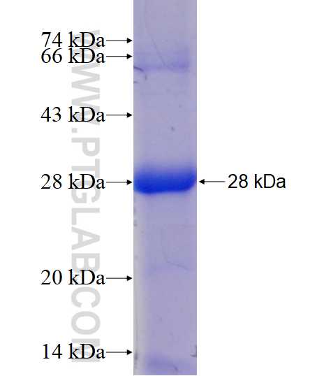 RNH1 fusion protein Ag18093 SDS-PAGE