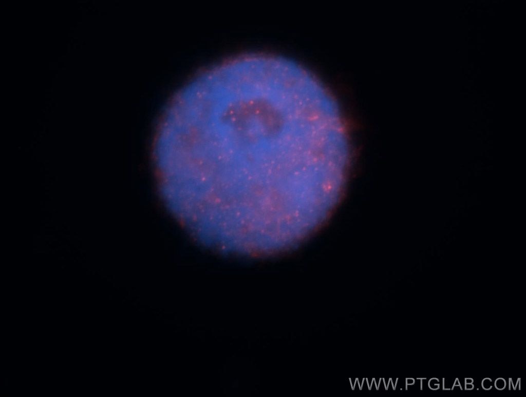 Immunofluorescence (IF) / fluorescent staining of HeLa cells using RNMT Polyclonal antibody (13743-1-AP)