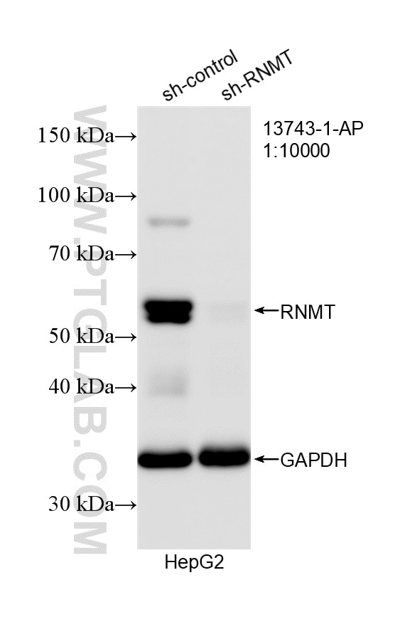 Western Blot (WB) analysis of HepG2 cells using RNMT Polyclonal antibody (13743-1-AP)