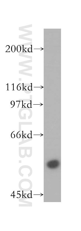 Western Blot (WB) analysis of human kidney tissue using RNMT Polyclonal antibody (13743-1-AP)