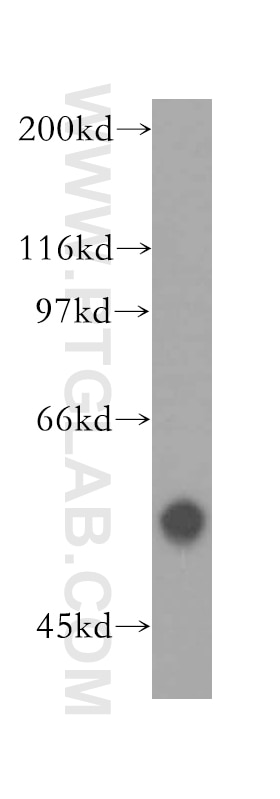 Western Blot (WB) analysis of HeLa cells using RNMT Polyclonal antibody (13743-1-AP)