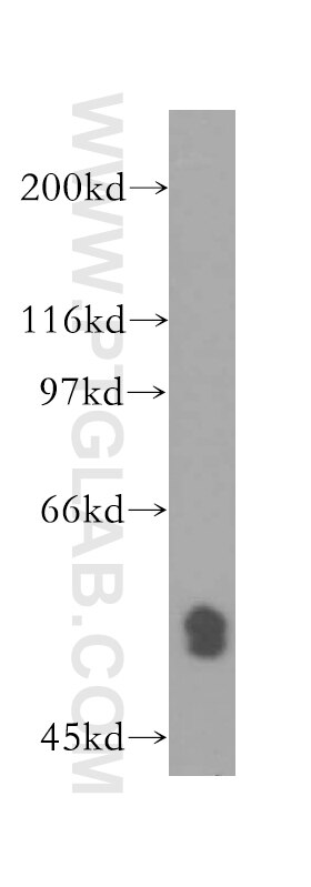 Western Blot (WB) analysis of human liver tissue using RNMT Polyclonal antibody (13743-1-AP)