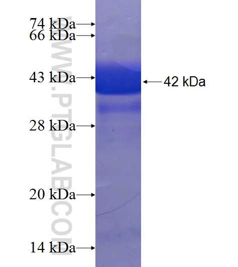 RNMT fusion protein Ag6953 SDS-PAGE