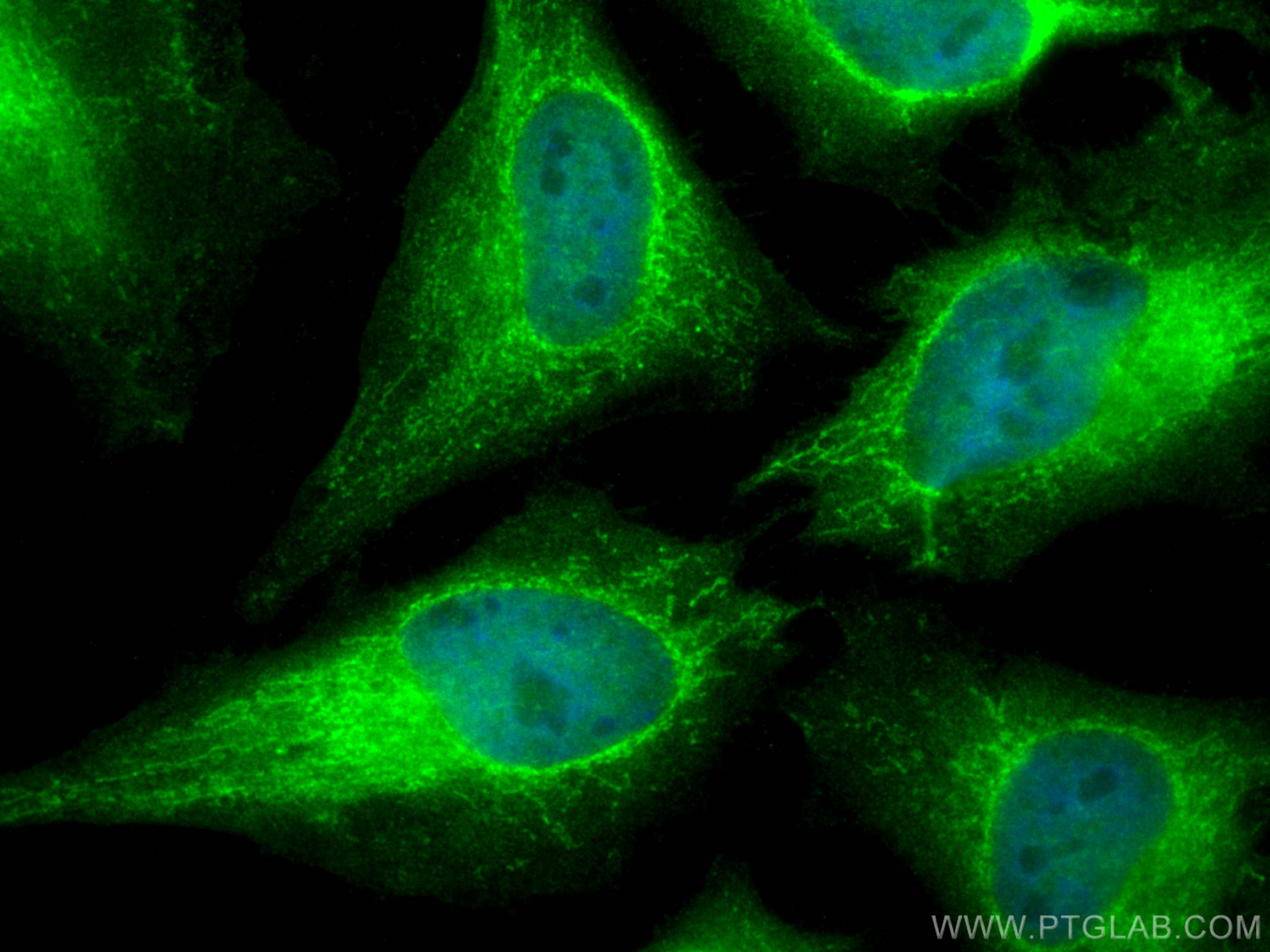 Immunofluorescence (IF) / fluorescent staining of HeLa cells using RNMTL1 Polyclonal antibody (14707-1-AP)