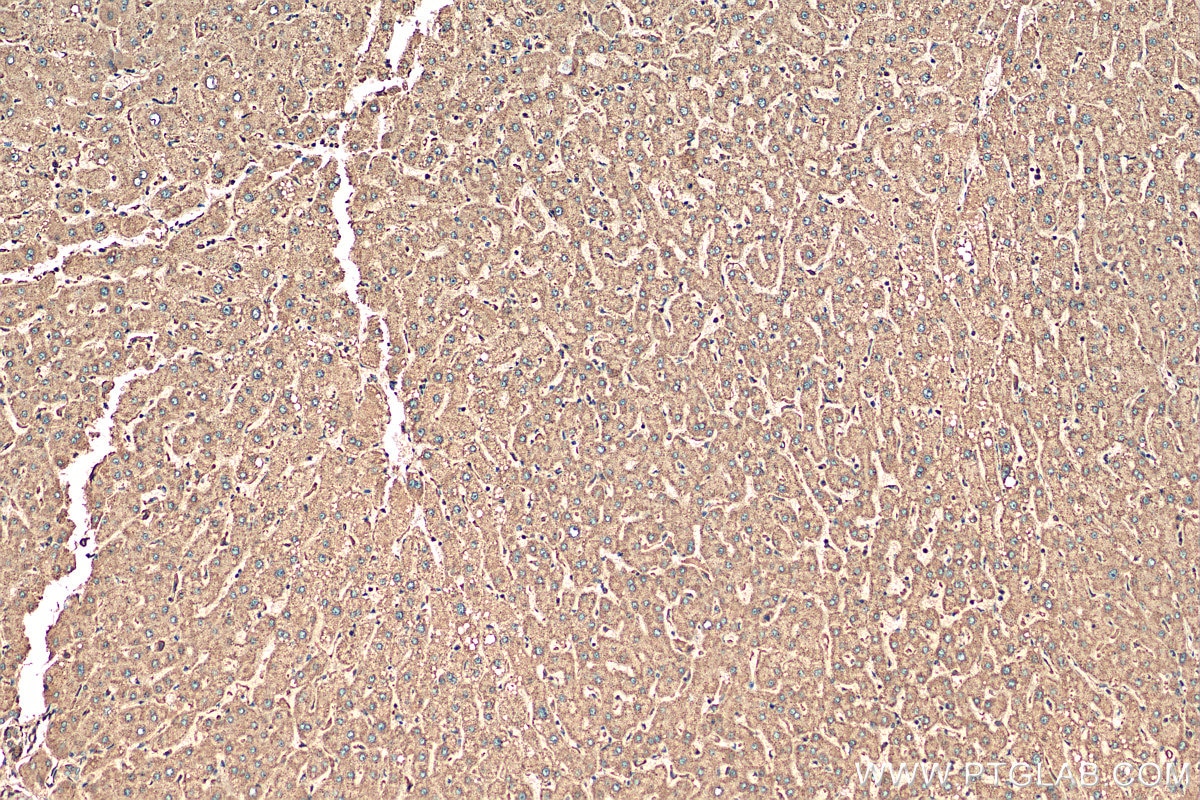Immunohistochemistry (IHC) staining of human liver tissue using RNMTL1 Polyclonal antibody (14707-1-AP)