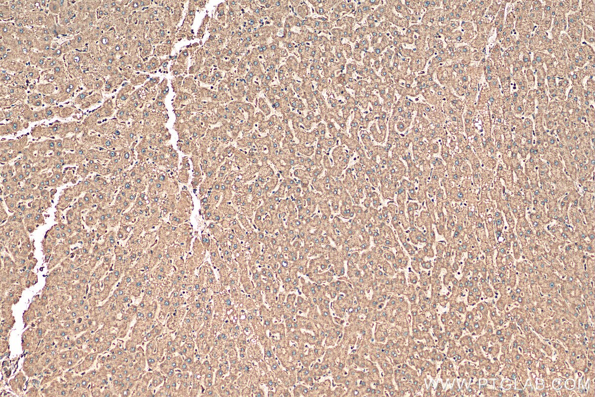 IHC staining of human liver using 14707-1-AP