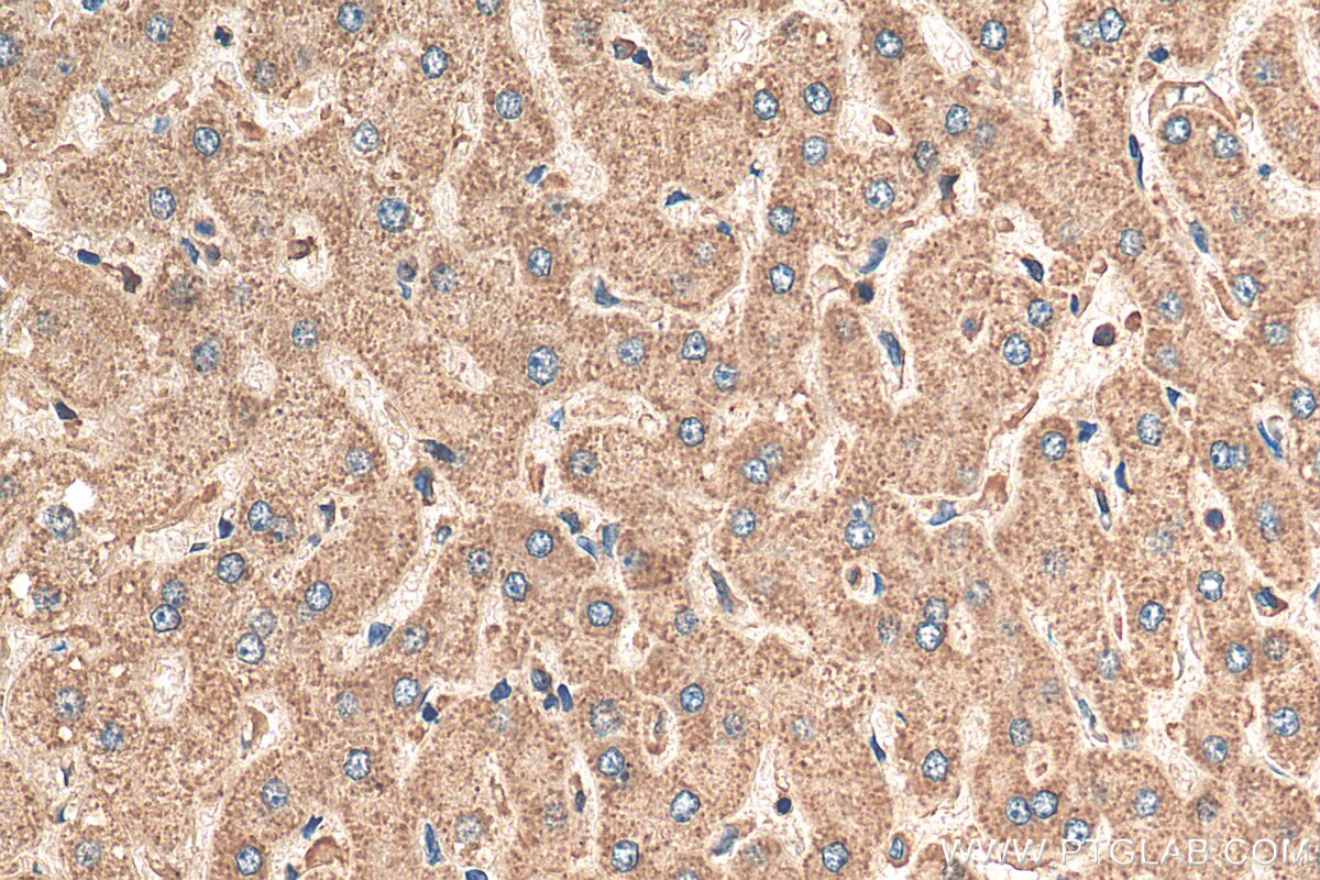 Immunohistochemistry (IHC) staining of human liver tissue using RNMTL1 Polyclonal antibody (14707-1-AP)