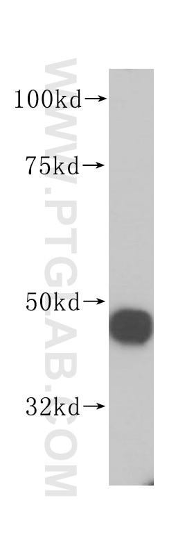 Western Blot (WB) analysis of HeLa cells using RNMTL1 Polyclonal antibody (14707-1-AP)