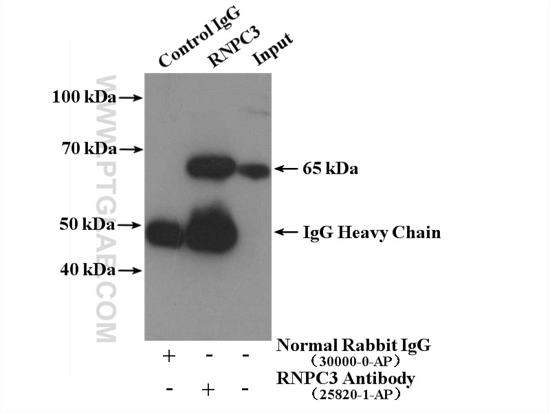 Immunoprecipitation (IP) experiment of mouse spleen tissue using RNPC3 Polyclonal antibody (25820-1-AP)