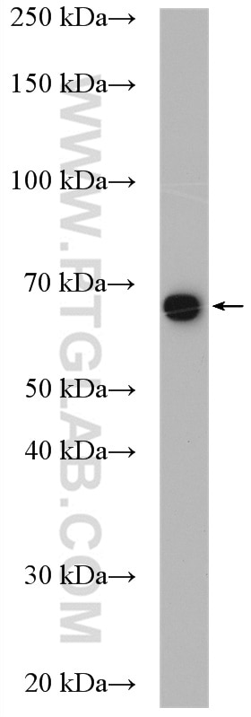 Western Blot (WB) analysis of 3T3-L1 cells using RNPC3 Polyclonal antibody (25820-1-AP)