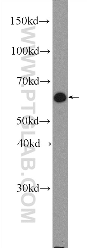 Western Blot (WB) analysis of mouse spleen tissue using RNPC3 Polyclonal antibody (25820-1-AP)