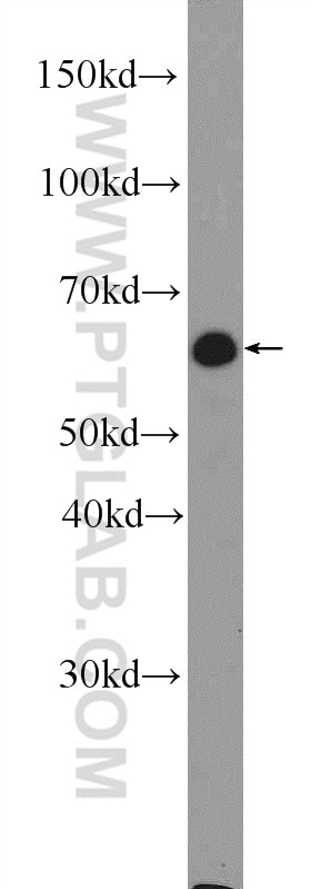 WB analysis of mouse spleen using 25820-1-AP