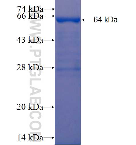 RNPC3 fusion protein Ag22957 SDS-PAGE