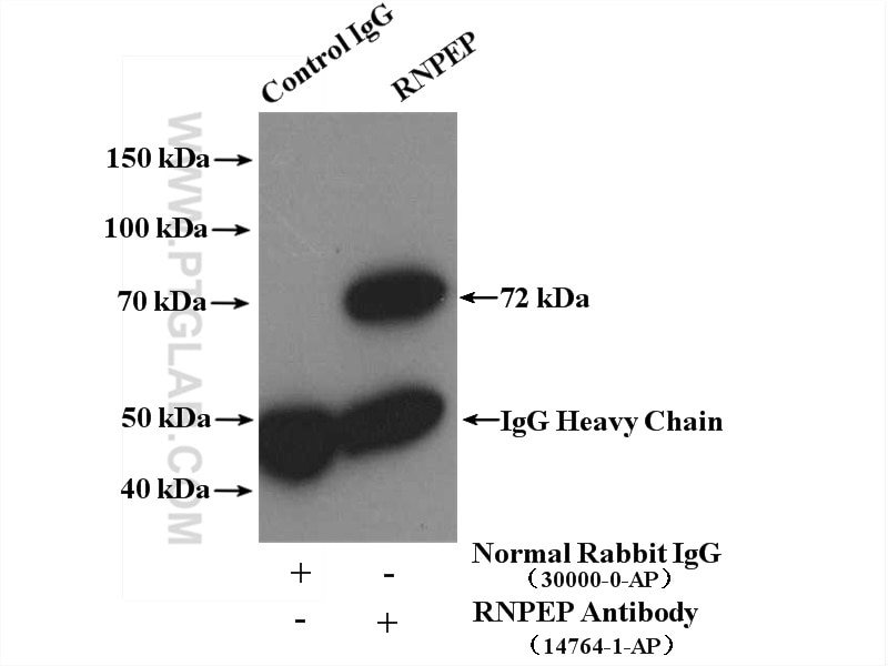 Immunoprecipitation (IP) experiment of A549 cells using RNPEP Polyclonal antibody (14764-1-AP)