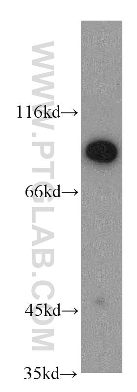 Western Blot (WB) analysis of HepG2 cells using RNPEP Polyclonal antibody (14764-1-AP)