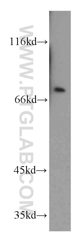 Western Blot (WB) analysis of A549 cells using RNPEP Polyclonal antibody (14764-1-AP)