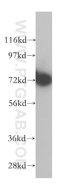 Western Blot (WB) analysis of HeLa cells using RNPEP Polyclonal antibody (14764-1-AP)