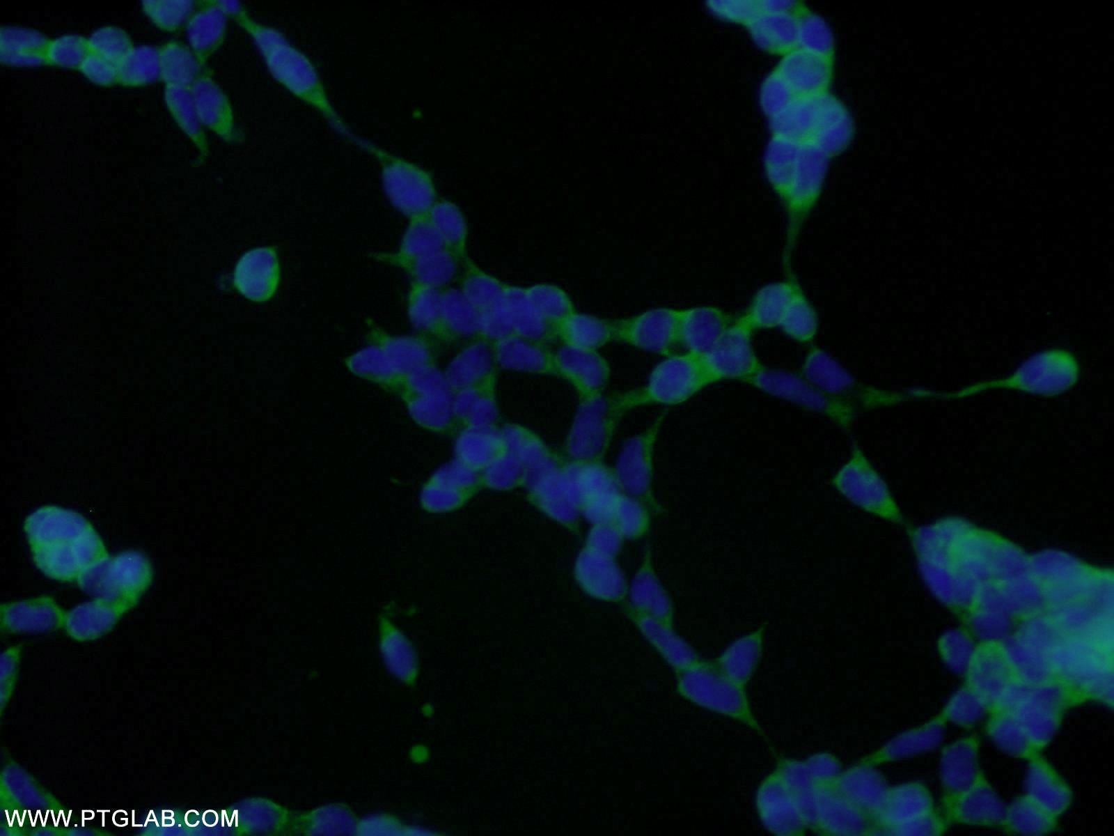 Immunofluorescence (IF) / fluorescent staining of HEK-293 cells using RNPS1 Polyclonal antibody (10555-1-AP)