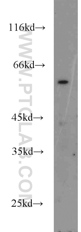 Western Blot (WB) analysis of mouse brain tissue using RNPS1 Polyclonal antibody (10555-1-AP)