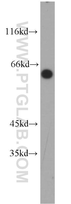 Western Blot (WB) analysis of mouse kidney tissue using RNPS1 Polyclonal antibody (10555-1-AP)