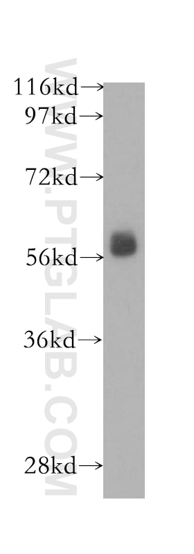 Western Blot (WB) analysis of human brain tissue using RNPS1 Polyclonal antibody (10555-1-AP)