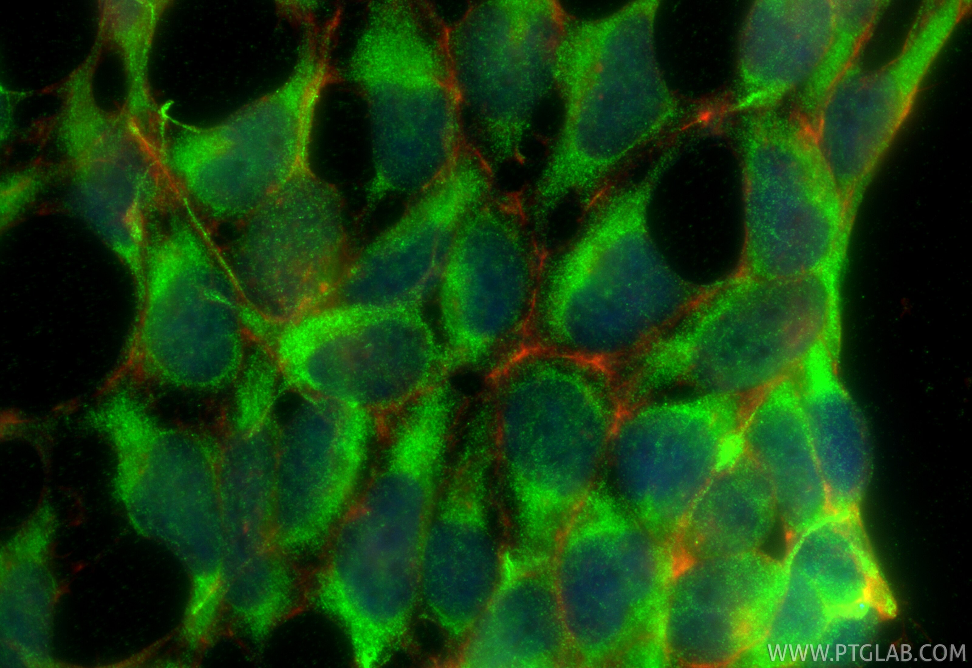 Immunofluorescence (IF) / fluorescent staining of HEK-293 cells using RNPS1 Polyclonal antibody (32844-1-AP)