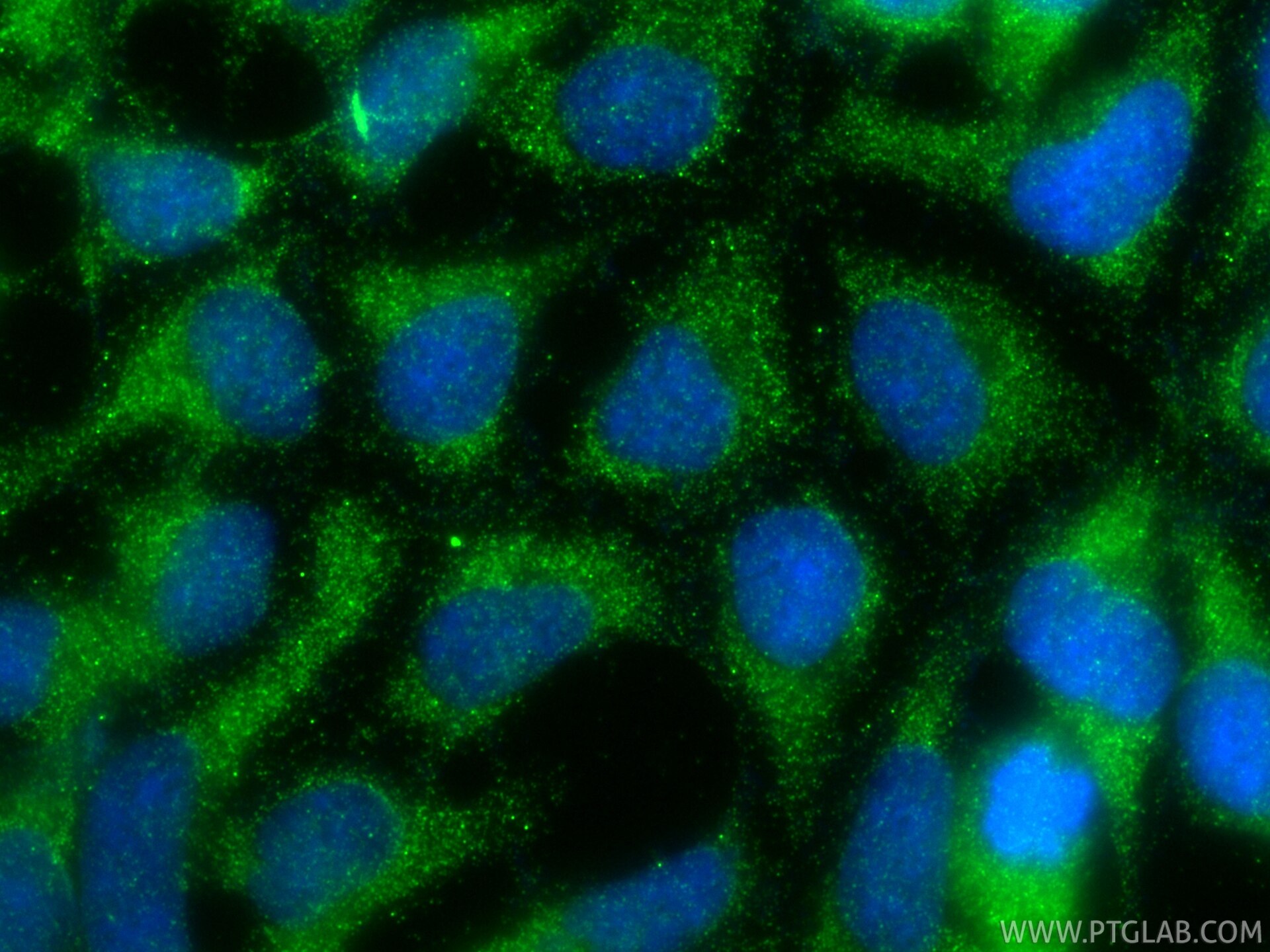 IF Staining of HEK-293 using 32844-1-AP Immunofluorescence (IF) / fluorescent staining of HEK-293 cells using RNPS1 Polyclonal antibody (32844-1-AP)