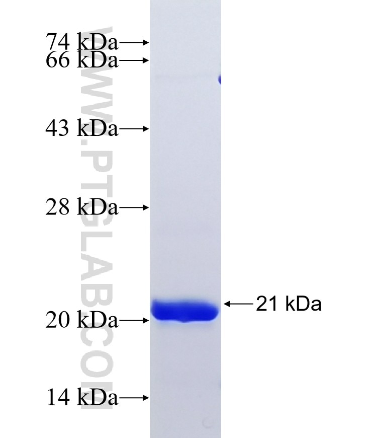 RNPS1 fusion protein Ag37883 SDS-PAGE RNPS1 fusion protein Ag37883 SDS-PAGE
