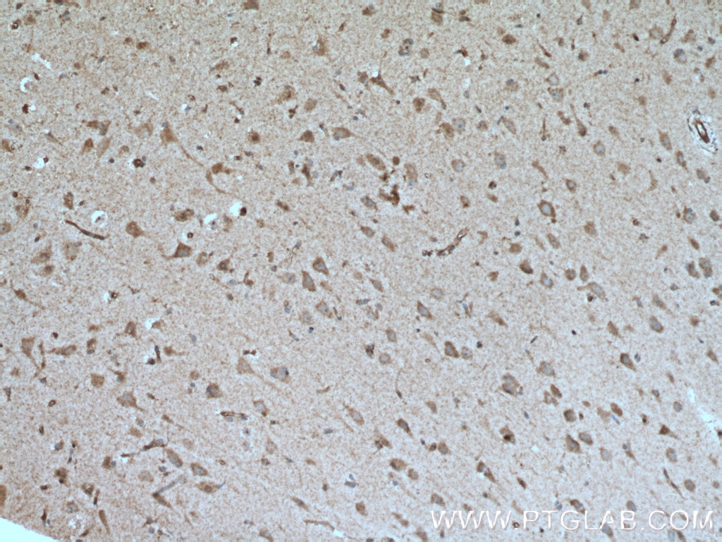 Immunohistochemistry (IHC) staining of human brain tissue using ROBO1 Polyclonal antibody (25181-1-AP)