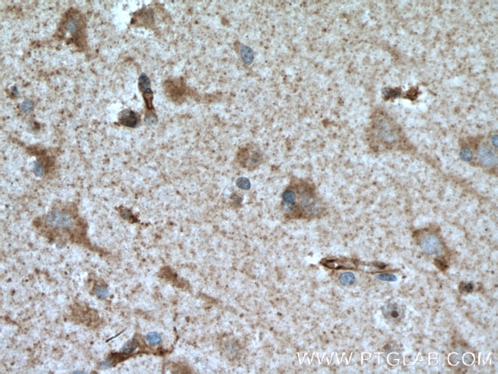 ROBO1 Polyclonal antibody