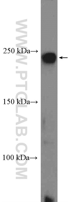 Western Blot (WB) analysis of Y79 cells using ROBO1 Polyclonal antibody (25181-1-AP)