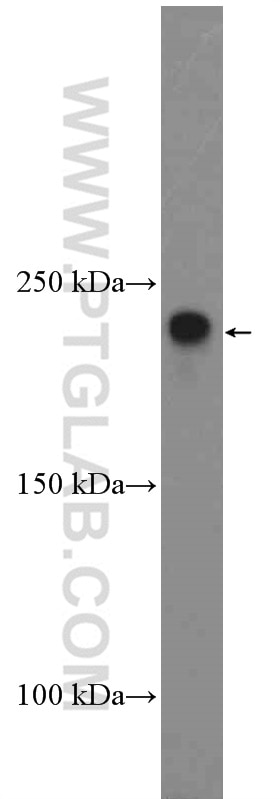 Western Blot (WB) analysis of HeLa cells using ROBO1 Polyclonal antibody (25181-1-AP)