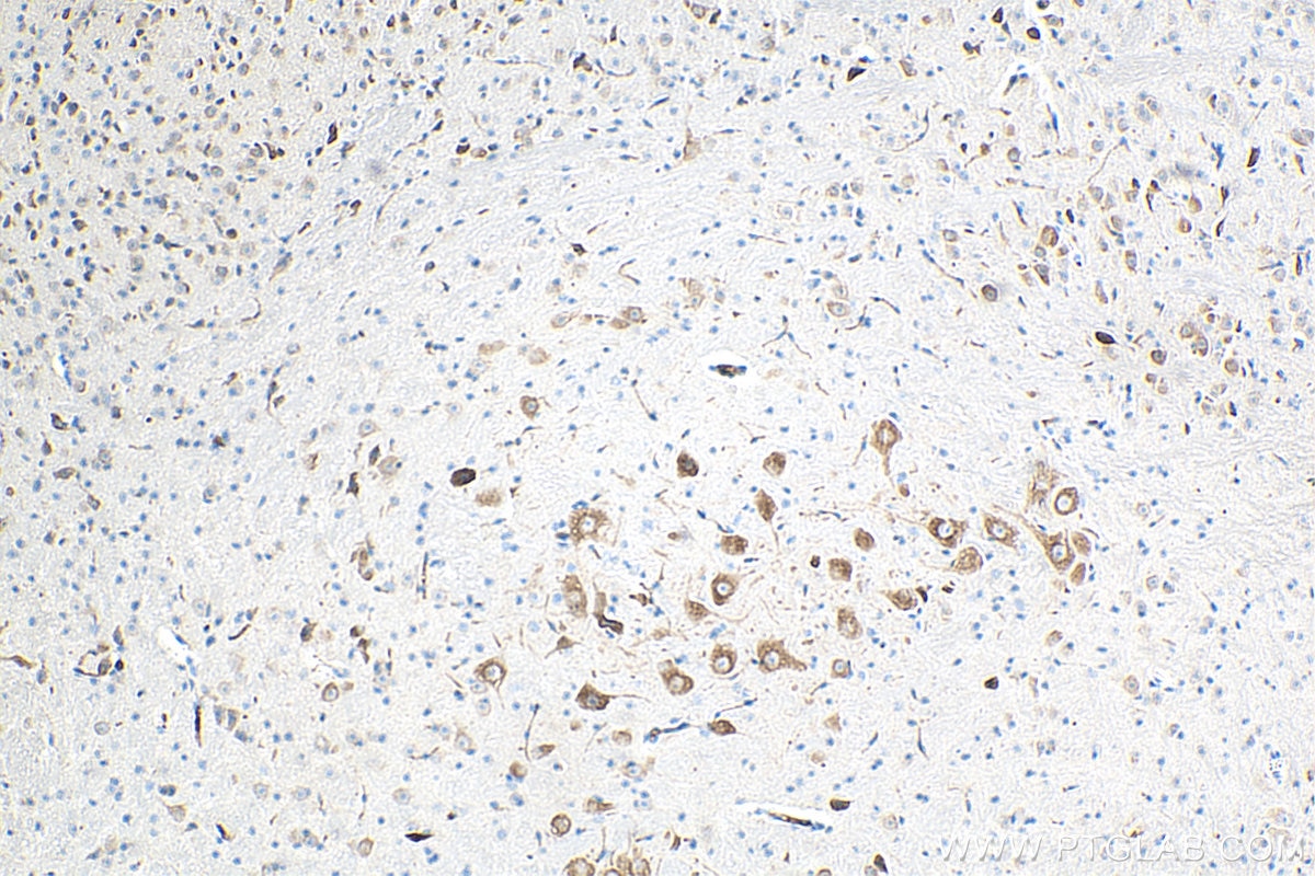 Immunohistochemistry (IHC) staining of mouse cerebellum tissue using ROBO1 Monoclonal antibody (67922-1-Ig)