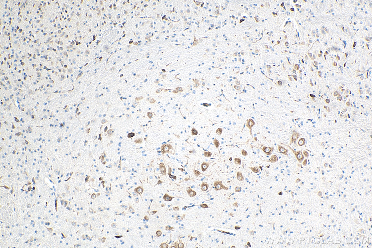 Immunohistochemistry (IHC) staining of mouse cerebellum tissue using ROBO1 Monoclonal antibody (67922-1-Ig)