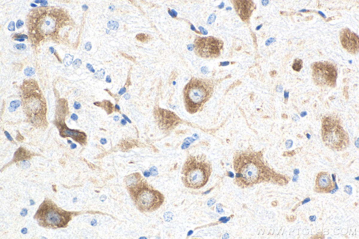 Immunohistochemistry (IHC) staining of mouse cerebellum tissue using ROBO1 Monoclonal antibody (67922-1-Ig)