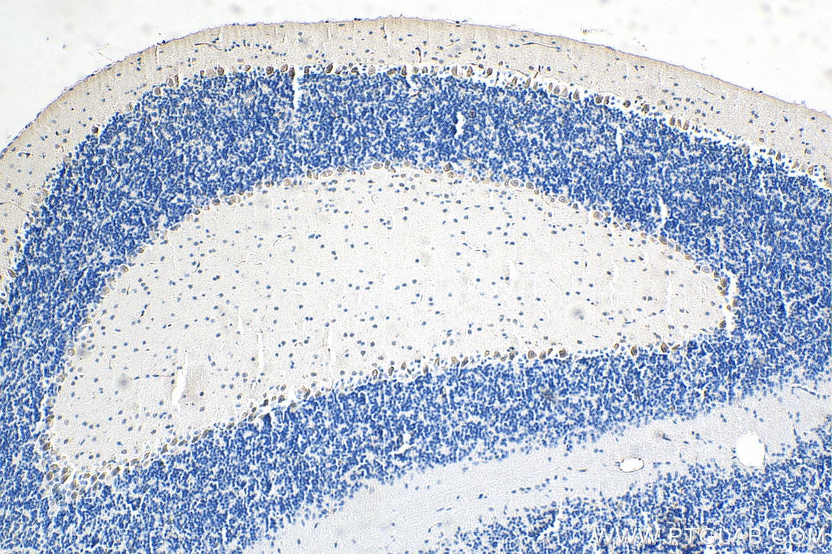 Immunohistochemistry (IHC) staining of mouse cerebellum tissue using ROBO1 Monoclonal antibody (67922-1-Ig)